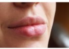 Ботокс в губы — процедуры для специалиста экстра-класса